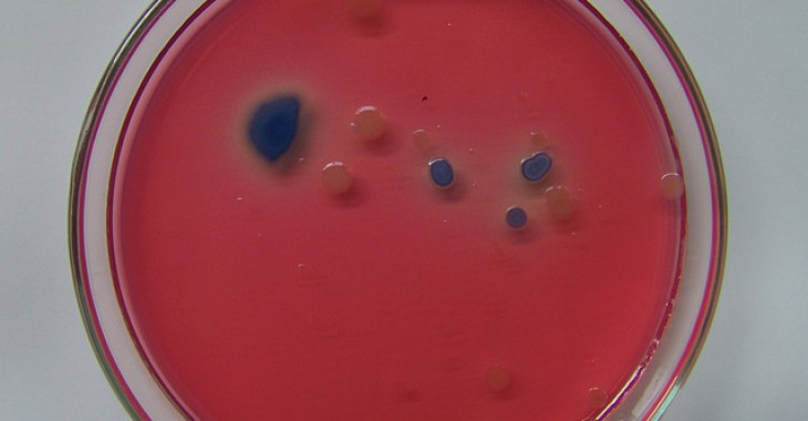 USA/Odkryto bakterię z genem oporności na najważniejsze antybiotyki