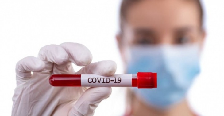 Szybki test na koronawirusa a jakość – dane ze świata