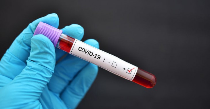 Instytucje odpowiedzialne za rejestrację produktów leczniczych precyzują wymagania 3 etapu badań klinicznych szczepionek przeciw COVID-19